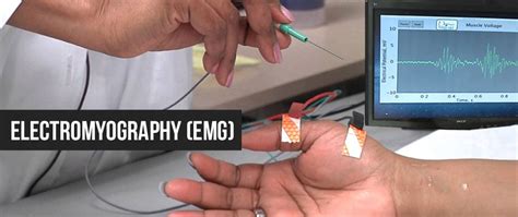 emg ultra hard test|emg test for muscle dystrophy.